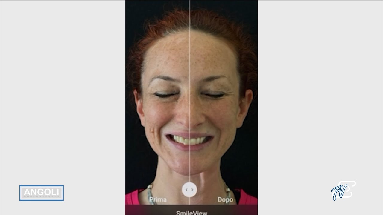 ANGOLI 29/5/2025: DOTT.SSA GIOVANNA PERROTTI - COME L'INTELLIGENZA ARTIFICIALE CAMBIA L'ORTODONZIA