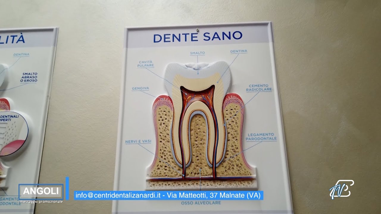 ANGOLI 12/1/2026: CENTRI DENTALI ZANARDI - ECCELLENZA RICONOSCIUTA NELL'IMPLANTOLOGIA DENTALE